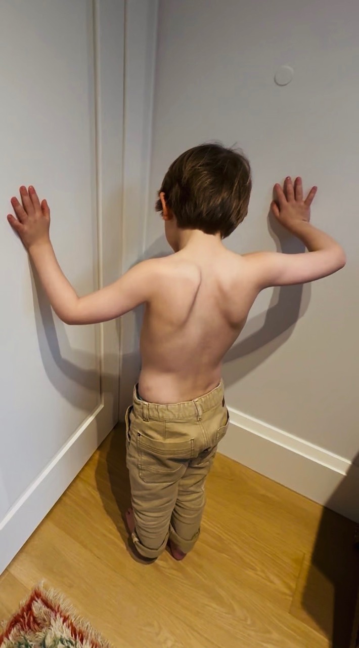 A boy stands facing a corner with his hands on the walls, his back and shoulder blades visible for a posture assessment.